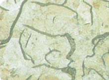Metallography of cast iron