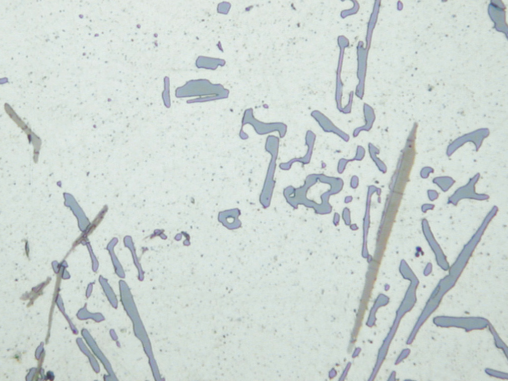 Aluminium alloy microstructure with silicon and Al-Fe-Si phase